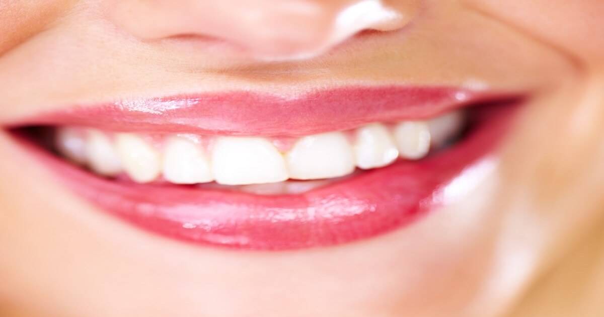 a gummy smile treatment